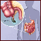 Appendicitis